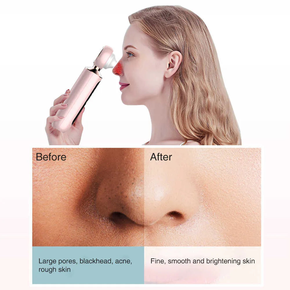 ʙᴜʏᴢᴇɴ™ Blackhead Suction Machine