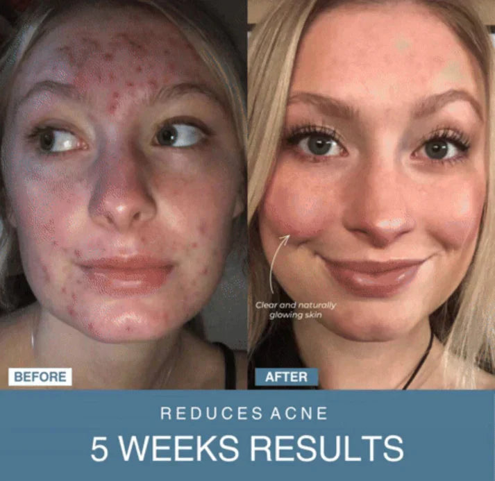 ʙᴜʏᴢᴇɴ™ 7-in-1 LED Anti-Aging/Wrinkle Apparatus