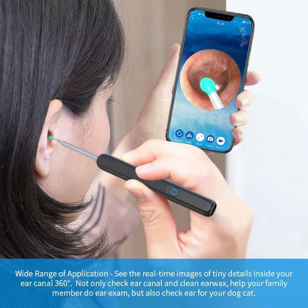 ʙᴜʏᴢᴇɴ™ Smart Ear Cleaning Device
