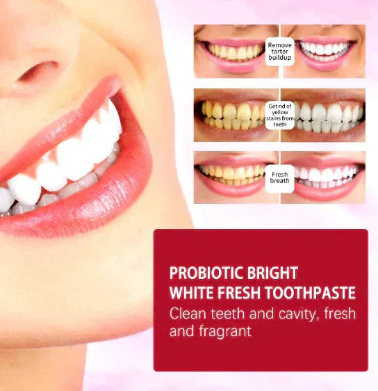 ʙᴜʏᴢᴇɴ™Sp-4 Toothpaste