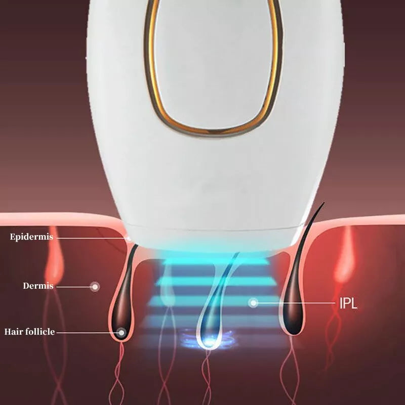 ʙᴜʏᴢᴇɴ™ IPL Laser Hair Removal – جهاز إزالة الشعر بالليزر IPL